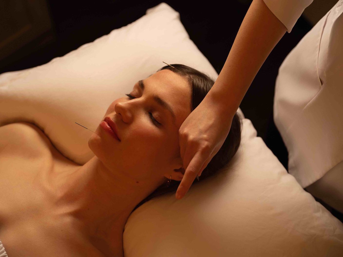 Acupuncture Treatments