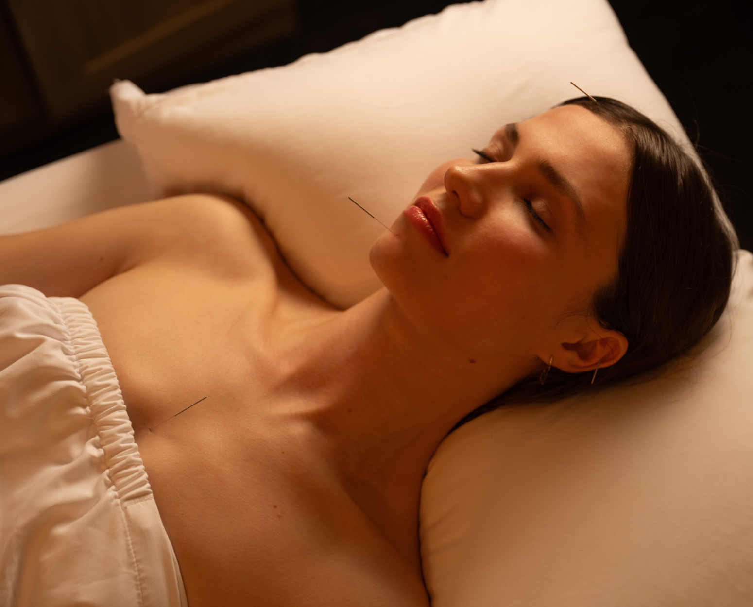 Essential ORA Method™Acupuncture